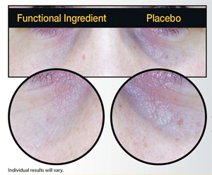 Hylexin Before and After