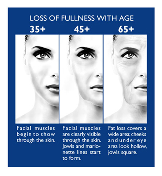 Loss of Fullness with Age