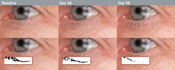 Before and After Eye Photos